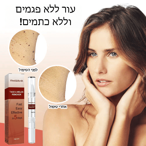 תגי SmoothTouch™ ומסיר שומות