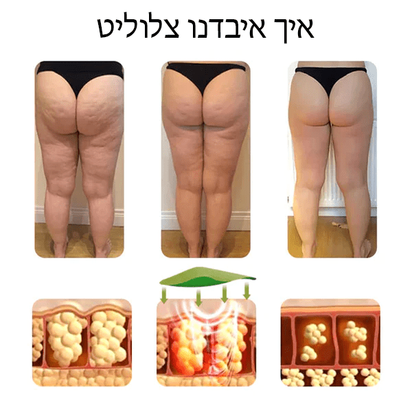 מדבקות להפחתת צלוליט CelluErase™