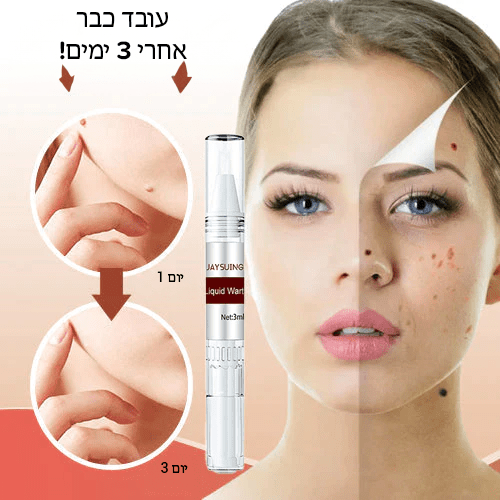 תגי SmoothTouch™ ומסיר שומות