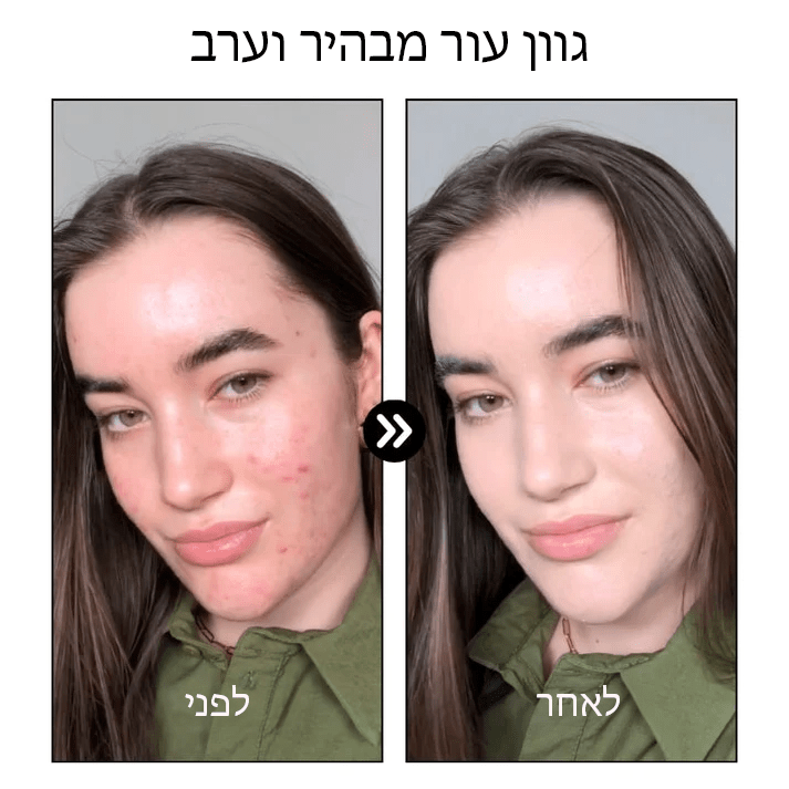 PoreClear™ 2% BHA נוזל לחידוש העור