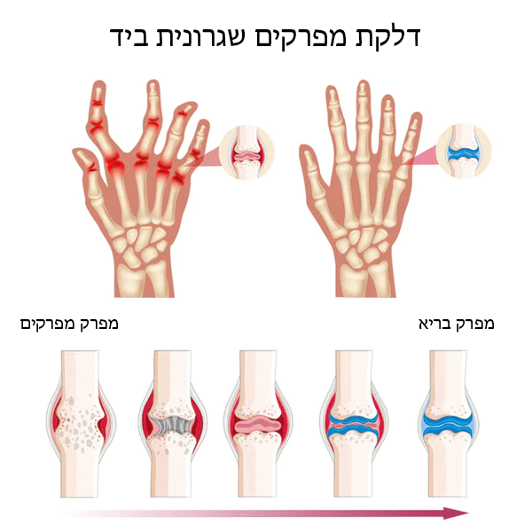 JointBuzz™ ניו זילנד קרם מתקדם לטיפול במפרקים ובעצם