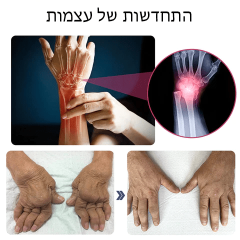 JointBuzz™ ניו זילנד קרם מתקדם לטיפול במפרקים ובעצם