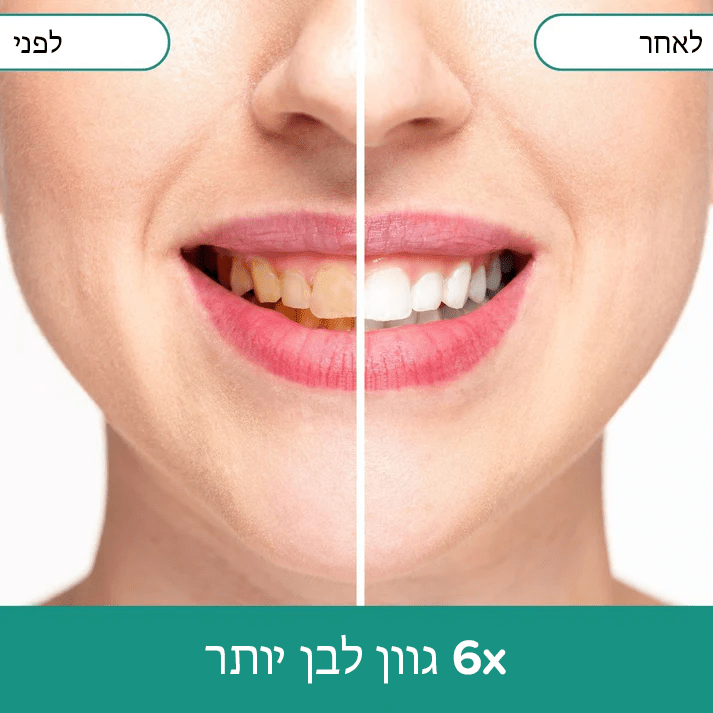 StainAway™ מסיר פלאק ומסיר כתמים