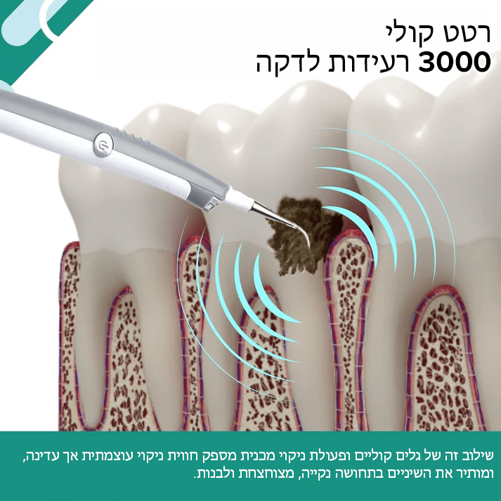 StainAway™ מסיר פלאק ומסיר כתמים