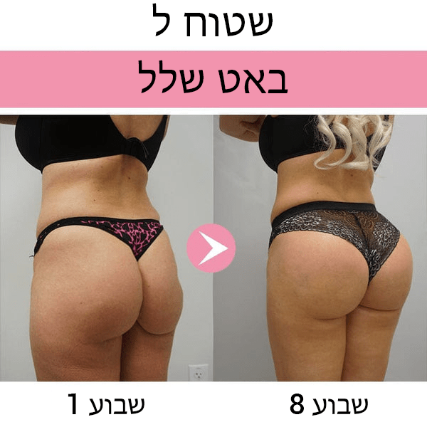 ButtMax™ קרם תחת לשיפור