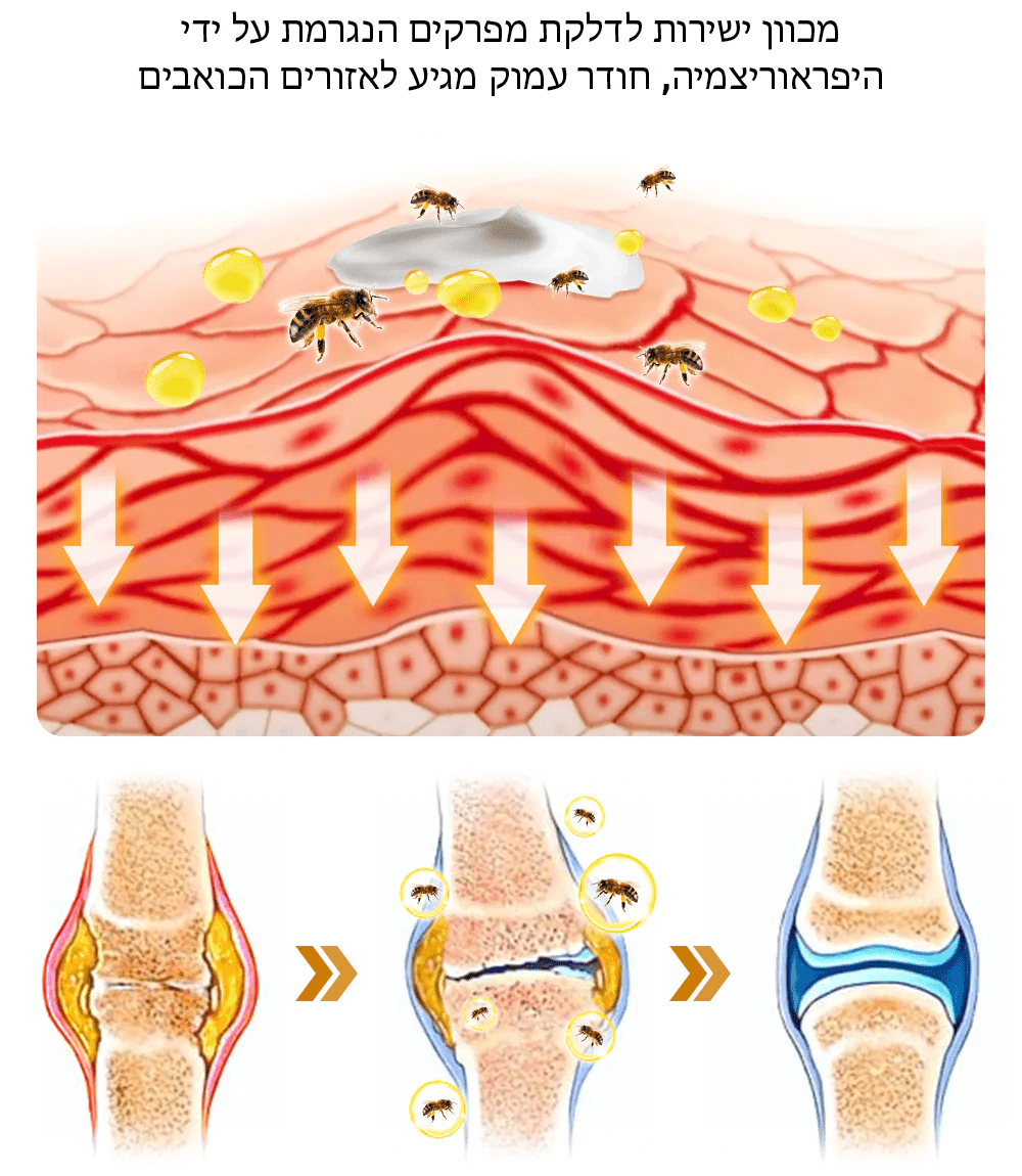 HyperBee™ קרם אנטי זיהום היפראוריצמיה ארס דבורים