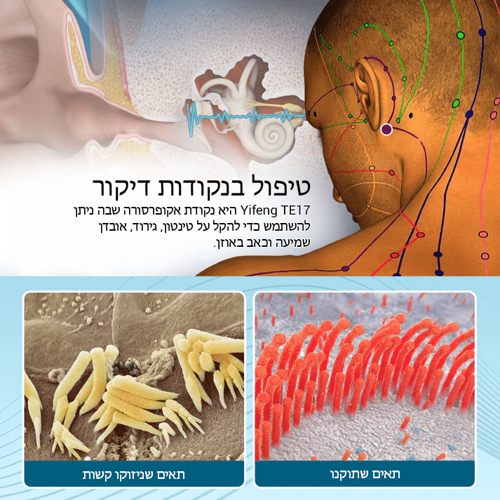 תיקון אוזניים לטיפול בטינטון TinniCalm™