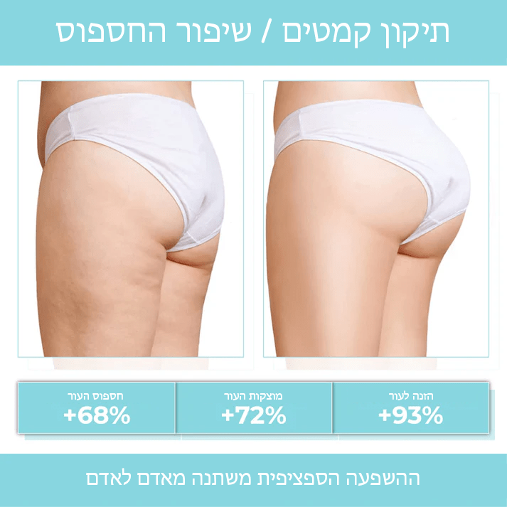 ATTDX™ קרם גוף מיצוק להרמת עור צעיר