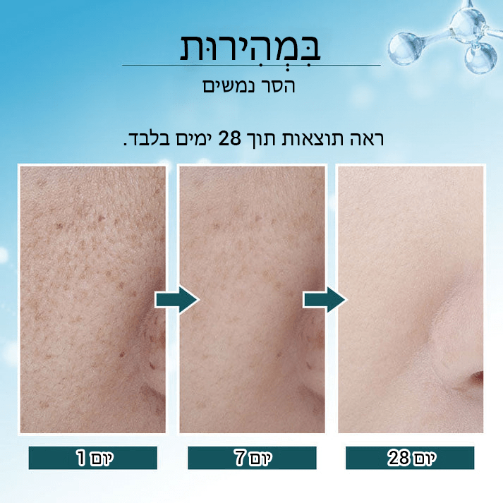 BrightSpot™ מסיר כתמים כהים מבהיר משולש פעיל