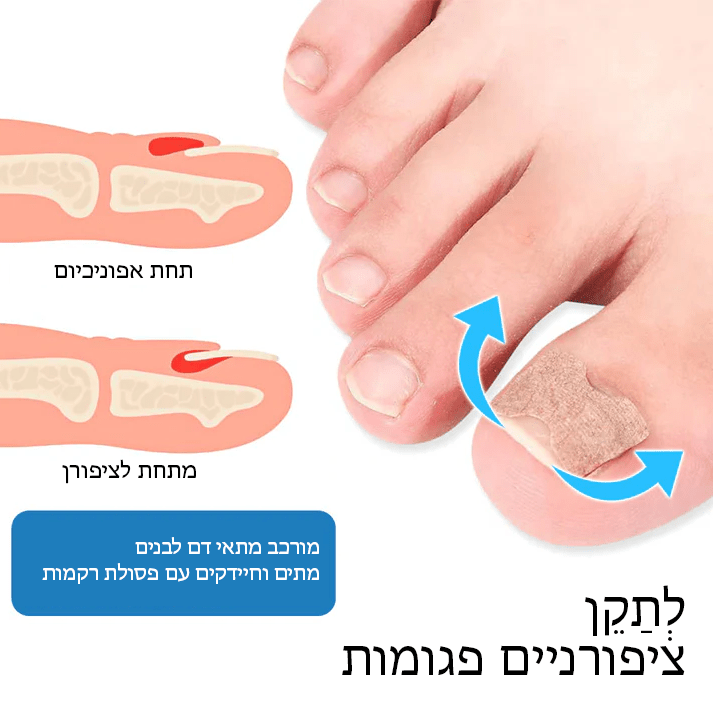 German ToenailHeal™ תיקון הפרוניכיה