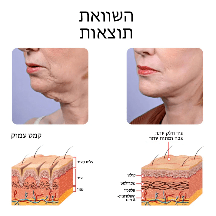 סרום פנים NMN™ אנטי אייג'ינג