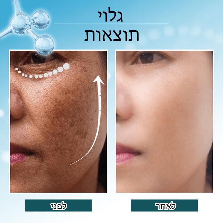 BrightSpot™ מסיר כתמים כהים מבהיר משולש פעיל