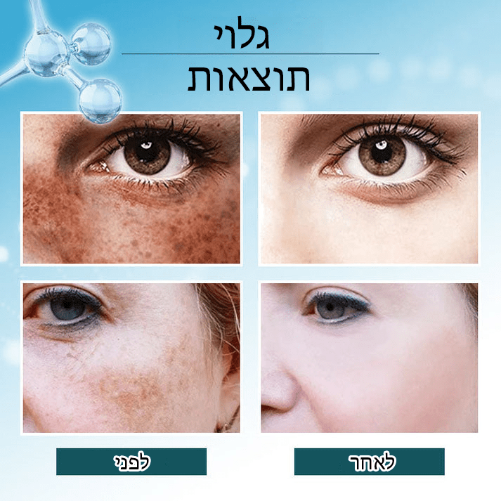 BrightSpot™ מסיר כתמים כהים מבהיר משולש פעיל