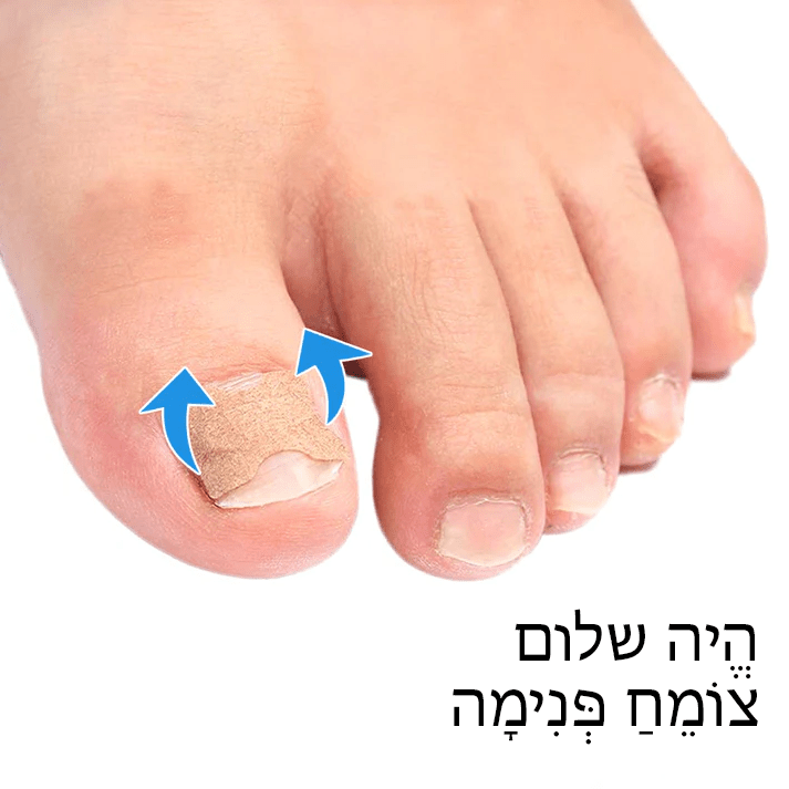 German ToenailHeal™ תיקון הפרוניכיה