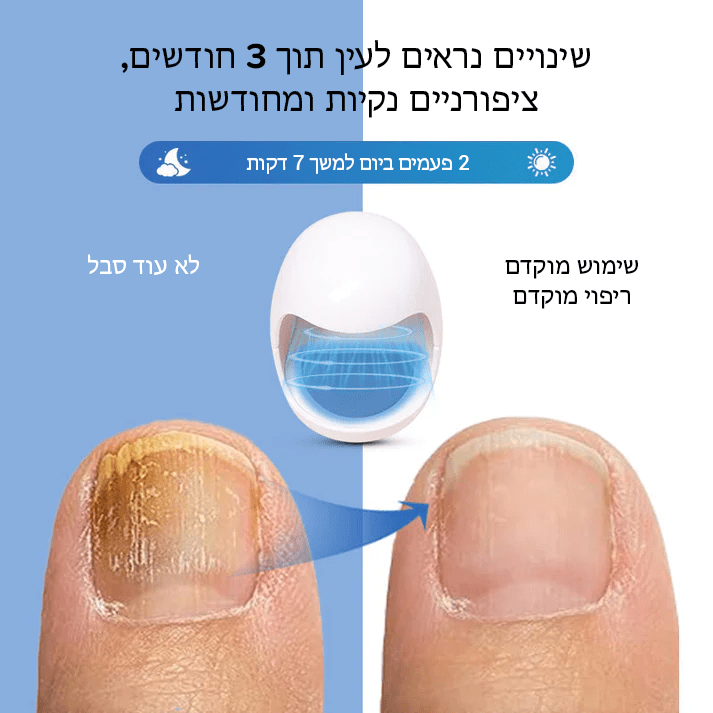 FungiFree™ מכשיר הקלה בלייזר לניקוי פטרת ציפורניים