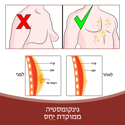 SleekChest™ תיקון התכה של צלוליט גינקומסטיה