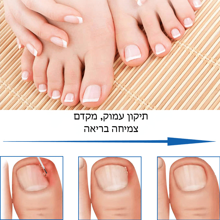 NailHeal™ ג'ל לתיקון ציפורניים צמחים