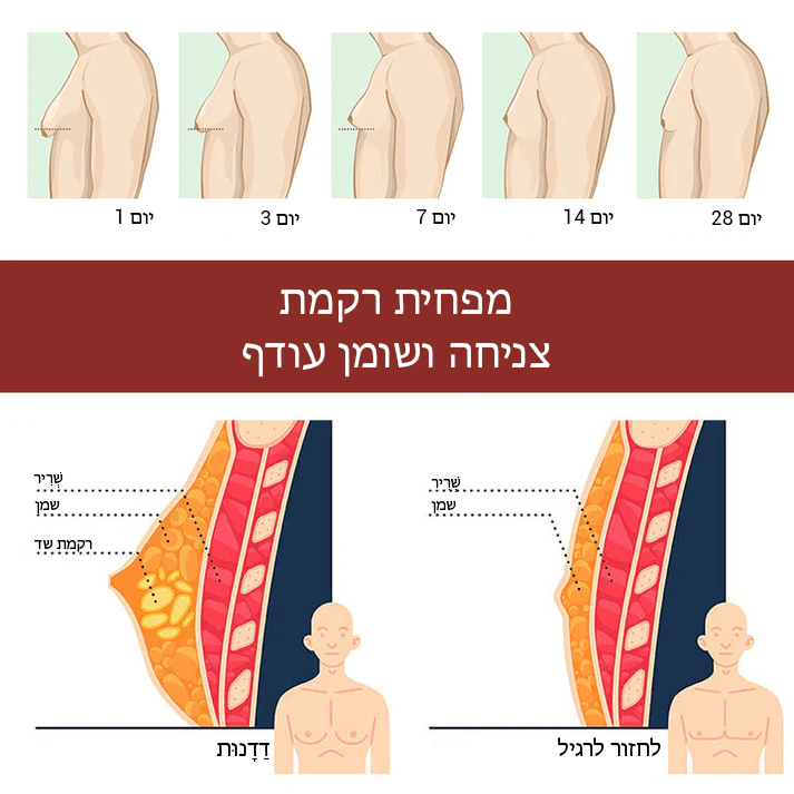 SleekChest™ תיקון התכה של צלוליט גינקומסטיה