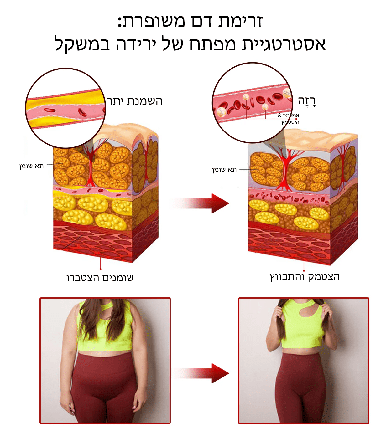 קרם אנטי-נפיחות מחטב ארס דבורים של BeeFit™