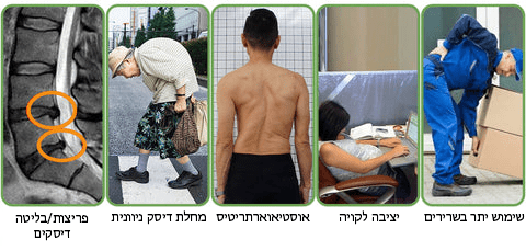 טיח צמחי מדגם LumbarFlex™