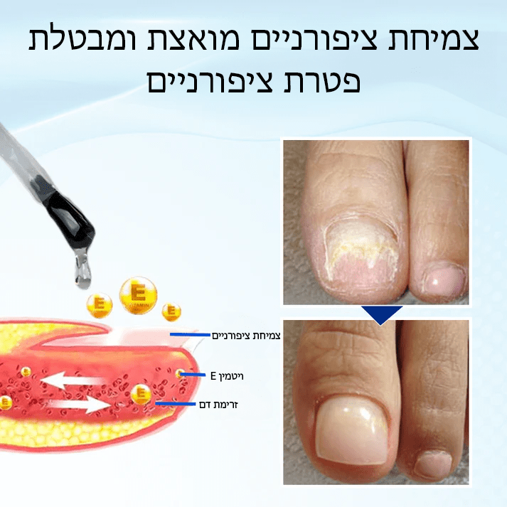 OnyxoGuard™ סרום לצמיחה ותיקון ציפורניים