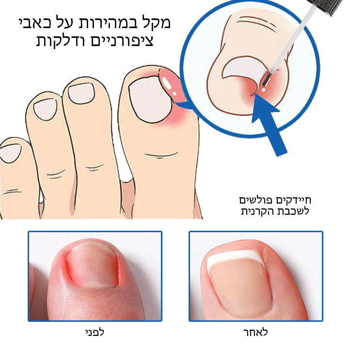 NailHeal™ ג'ל לתיקון ציפורניים צמחים