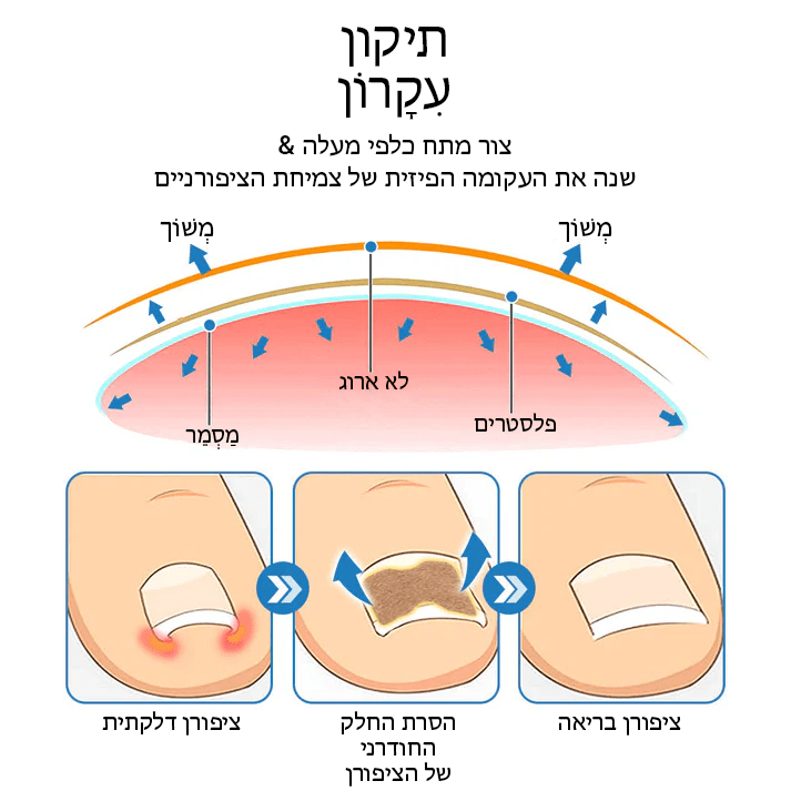 German ToenailHeal™ תיקון הפרוניכיה