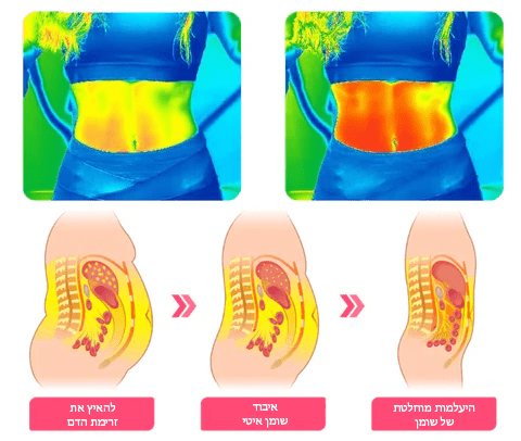 מכנסיים קצרים להרמת יונים ועיצוב של DreamFit™