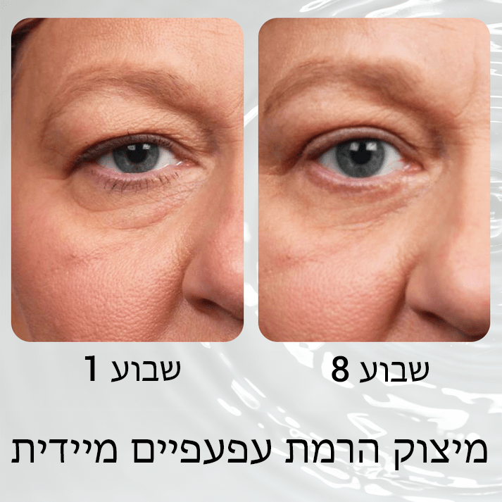 DermaFirm™ ג'ל פפטיד מיצוק עיניים