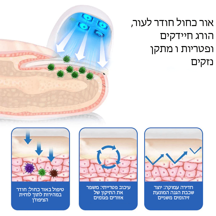 FungiFree™ מכשיר הקלה בלייזר לניקוי פטרת ציפורניים