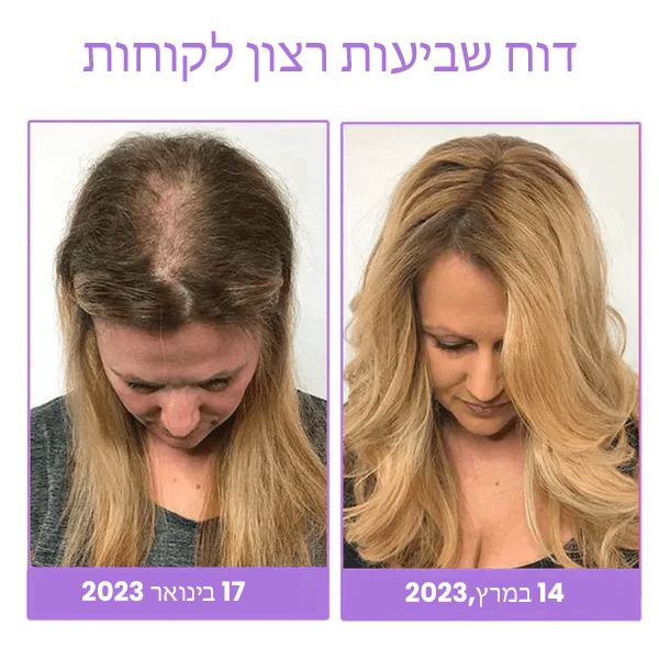 סרום צמיחת זקיקי שיער Fivfivgo™