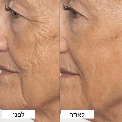 Glo™ טיפול כפול רטינול וקולגן פפטיד