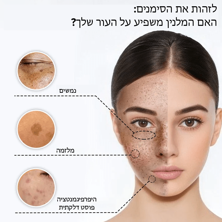 סרום עידון מלנין של VanishLux™