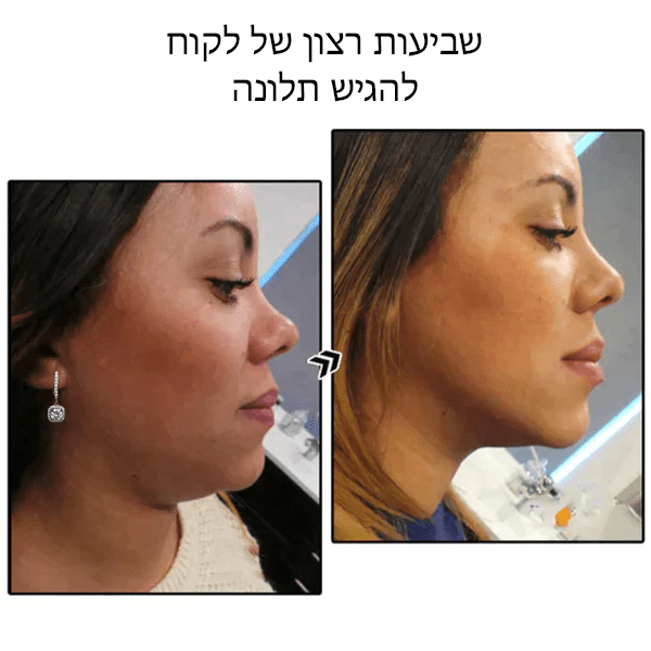 עגילי גרמניום מגנטולוגיה של אבן מוזמביק GeoLymph™